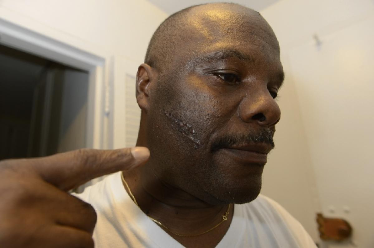 Nhà vệ sinh phát nổ: cẩn thận không thừa - Ảnh 2.