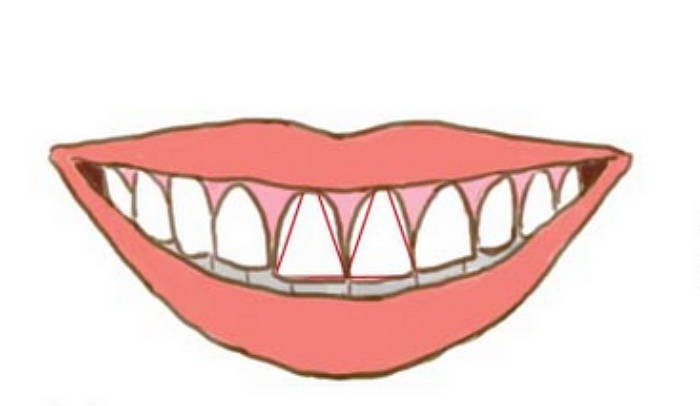 Nhìn răng biết tính cách? - Ảnh 4.