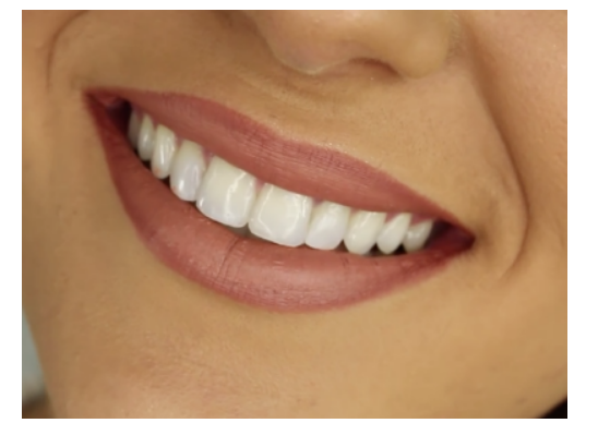 Nhìn răng biết tính cách? - Ảnh 2.