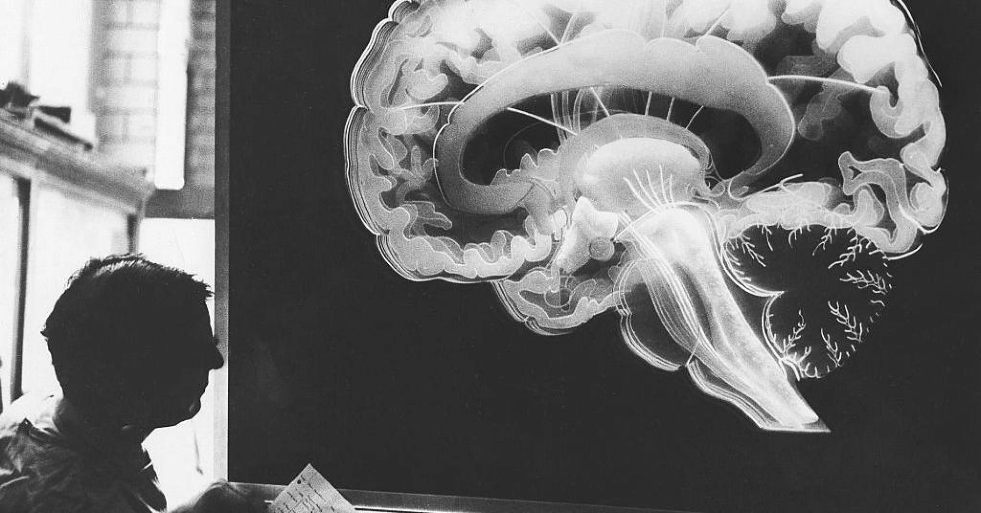 5 cách để bộ não không phản chủ - Ảnh 2. 5 cách để bộ não không phản chủ - Ảnh 2.