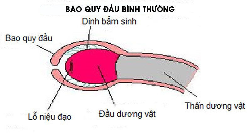 Đừng đưa bé đi nong bao quy đầu quá sớm! - Ảnh 1. Đừng đưa bé đi nong bao quy đầu quá sớm! - Ảnh 1.