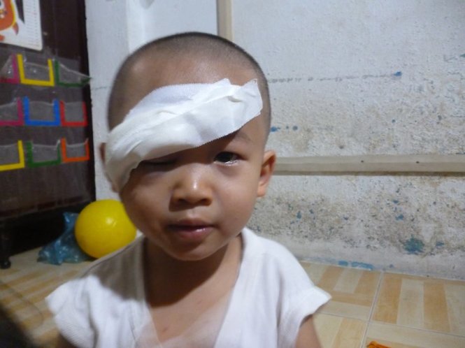 Cháu An Khang hiện chỉ nhìn được một mắt bên trái Ảnh: THIỆN TRÍ