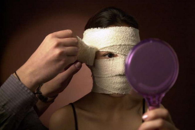 Quá sốc trước sự biến đổi của con do phẫu thuật thẩm mỹ, một bà mẹ Trung Quốc đã lên TV đòi từ con - Ảnh: ST