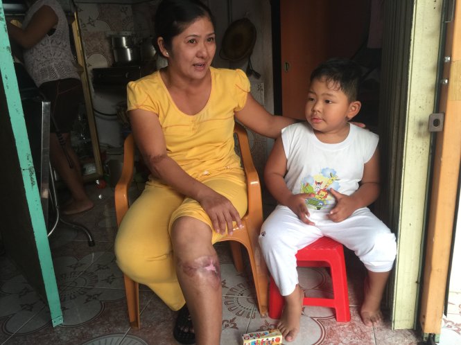 Chị Oanh kể lại vụ tai nạn khủng khiếp còn ám ảnh mẹ con chị - Ảnh: Gia Minh