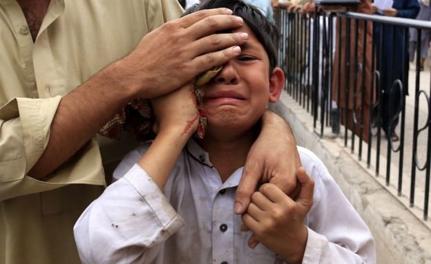 Một số người bị thương được ghi nhận ở Peshawar, Pakistan - Ảnh: BBC