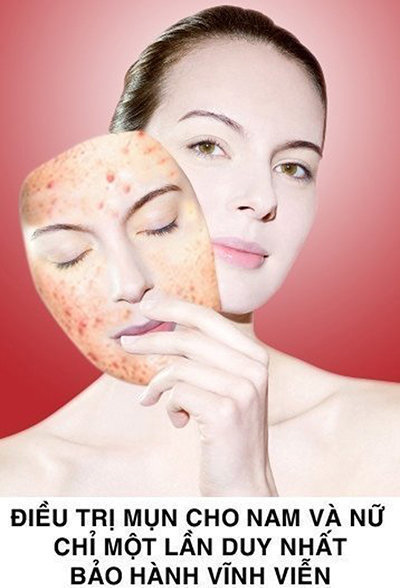 Kết quả điều trị tại thẩm mỹ viện Mỹ Nhân