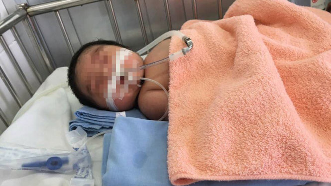 Cháu bé sơ sinh con của chị Gấm nằm điều trị tại Bệnh viện - Ảnh gia đình cung cấp
