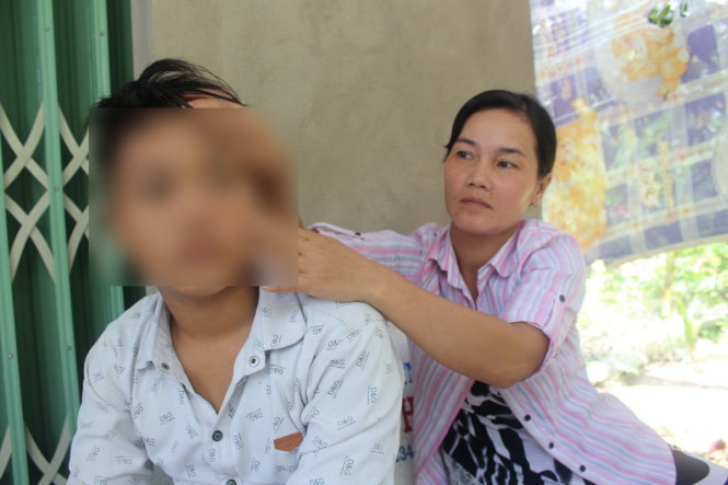 Chị Phê chỉ vết thương bầm tím trên mặt của cháu Tiến - Ảnh: HOÀI THƯƠNG
