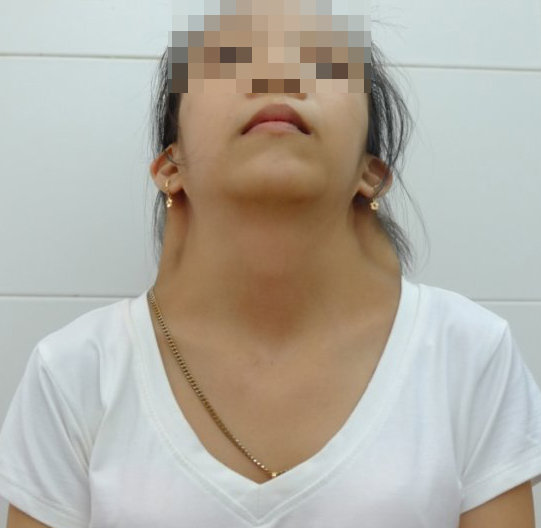 Em H. trước khi mổ - Ảnh: T.L.