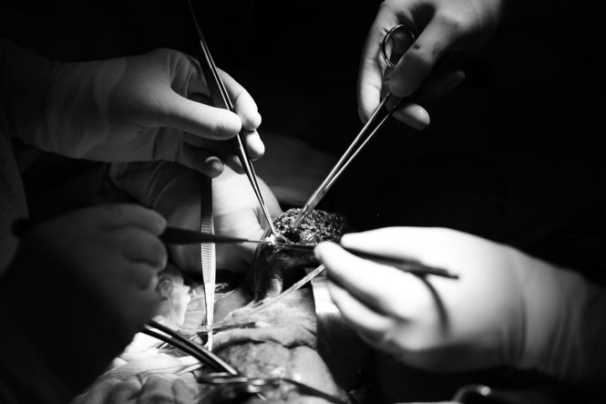 Dụng cụ phẫu thuật luôn là thứ phải được tiệt trùng cẩn thận, nhằm tránh lây nhiễm - Ảnh: HỮU KHOA