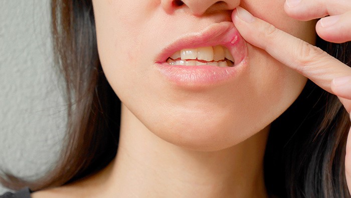 Các bệnh trong khoang miệng thường gặp - Ảnh 1. Các bệnh trong khoang miệng thường gặp - Ảnh 1.