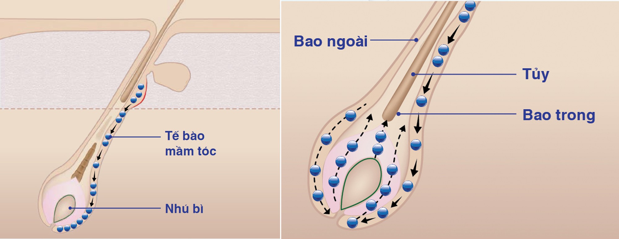 Quý ông hói đầu: cơ hội nào để tóc hồi sinh? - Ảnh 7.