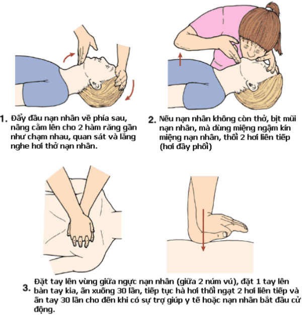 Sốc phản vệ - Ảnh 2. Sốc phản vệ - Ảnh 2.