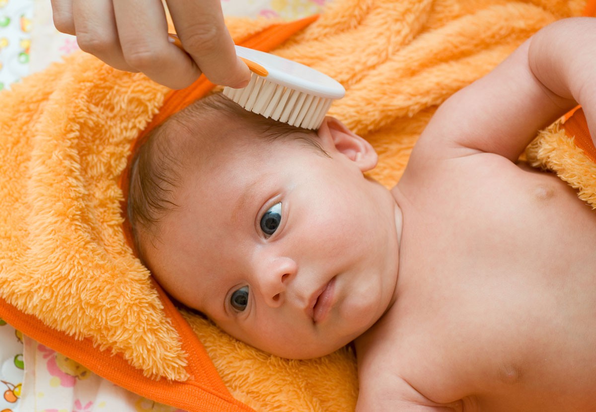 Rụng tóc ở trẻ em - Ảnh 1. Rụng tóc ở trẻ em - Ảnh 1.