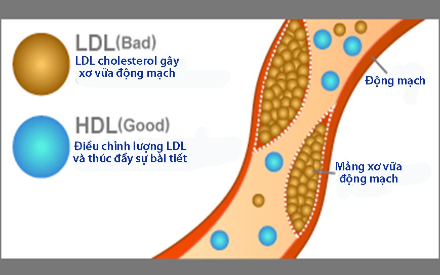 Phân biệt mỡ máu tốt và xấu - Ảnh 1. Phân biệt mỡ máu tốt và xấu - Ảnh 1.