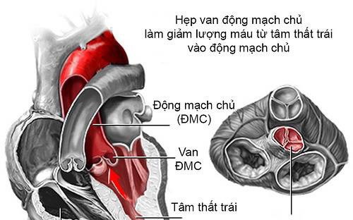 Bộ Y tế bỏ dự định khám sinh dục trong tiêu chuẩn sức khỏe lái tàu