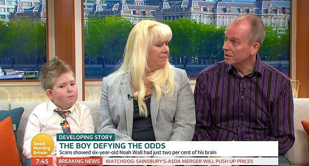 Sức sống kỳ diệu của cậu bé sinh ra ‘không có não’ - Ảnh 2.