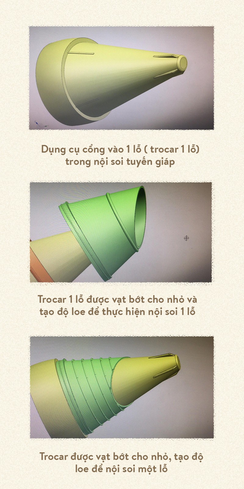 Mổ nội soi - hành trình Việt Nam vươn lên hàng đầu khu vực - Ảnh 17.