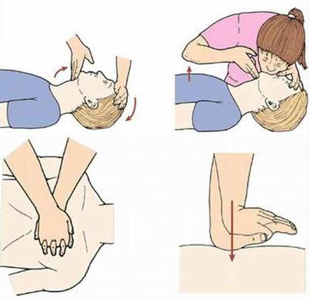 Cứu người đuối nước: Đừng xốc nước, hãy thổi ngạt - Ảnh 2. Cứu người đuối nước: Đừng xốc nước, hãy thổi ngạt - Ảnh 2.