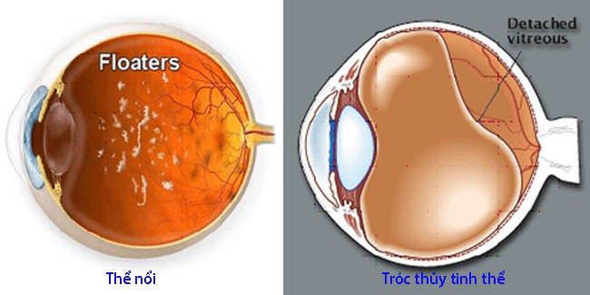 Thể nổi và chớp sáng - Ảnh 1. Thể nổi và chớp sáng - Ảnh 1.