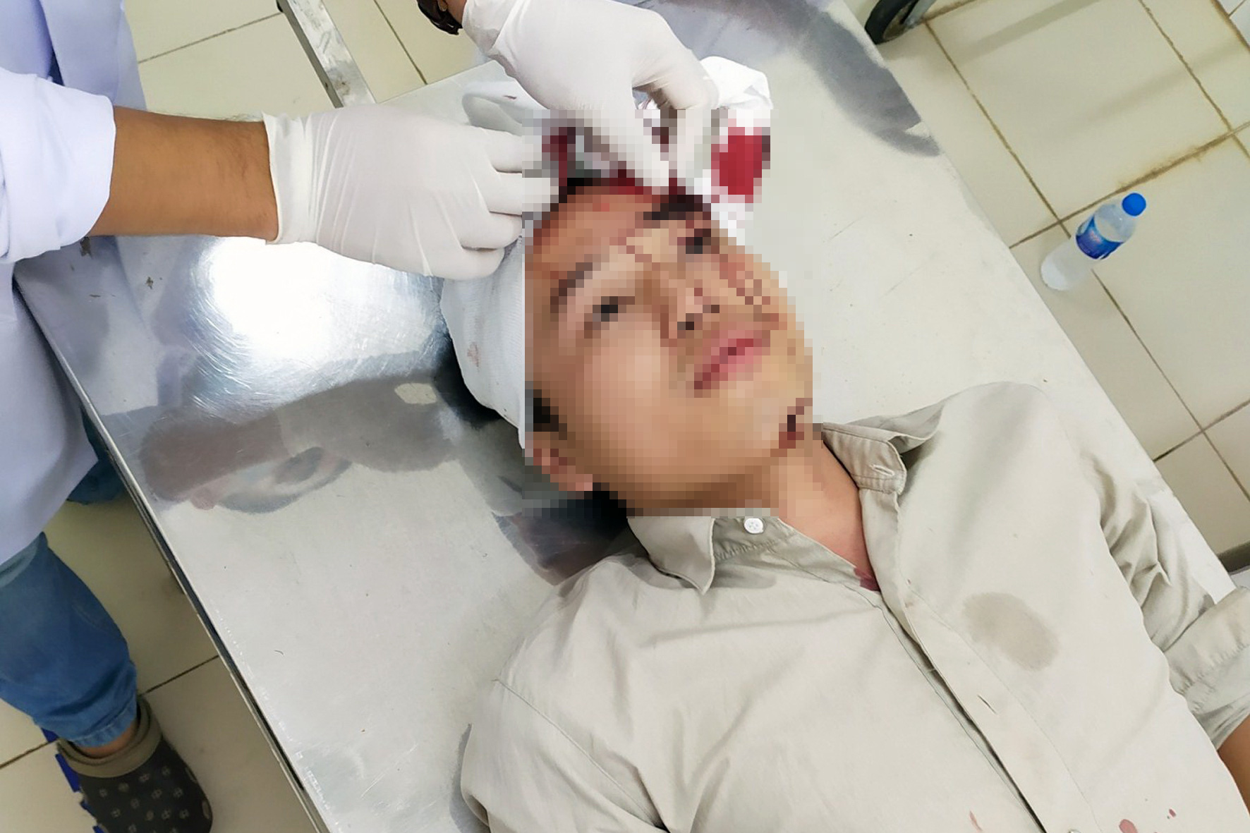 Nhóm côn đồ cầm dao vào trạm Cù Đinh đánh một kiểm lâm viên nhập viện - Ảnh 1. Nhóm côn đồ cầm dao vào trạm Cù Đinh đánh một kiểm lâm viên nhập viện - Ảnh 1.