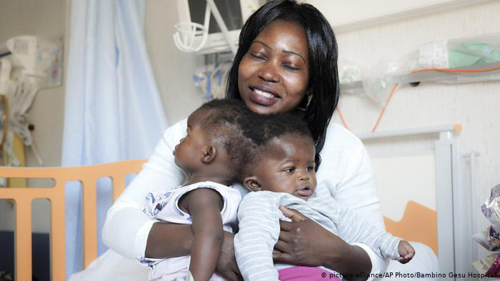 Những ca phẫu thuật tách trẻ song sinh dính nhau kỳ diệu trên thế giới - Ảnh 1. Những ca phẫu thuật tách trẻ song sinh dính nhau kỳ diệu trên thế giới - Ảnh 1.