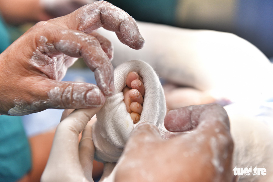 Đã tách rời xong cặp song sinh Trúc Nhi - Diệu Nhi, đưa ra khỏi phòng mổ - Ảnh 2. Đã tách rời xong cặp song sinh Trúc Nhi - Diệu Nhi, đưa ra khỏi phòng mổ - Ảnh 2.