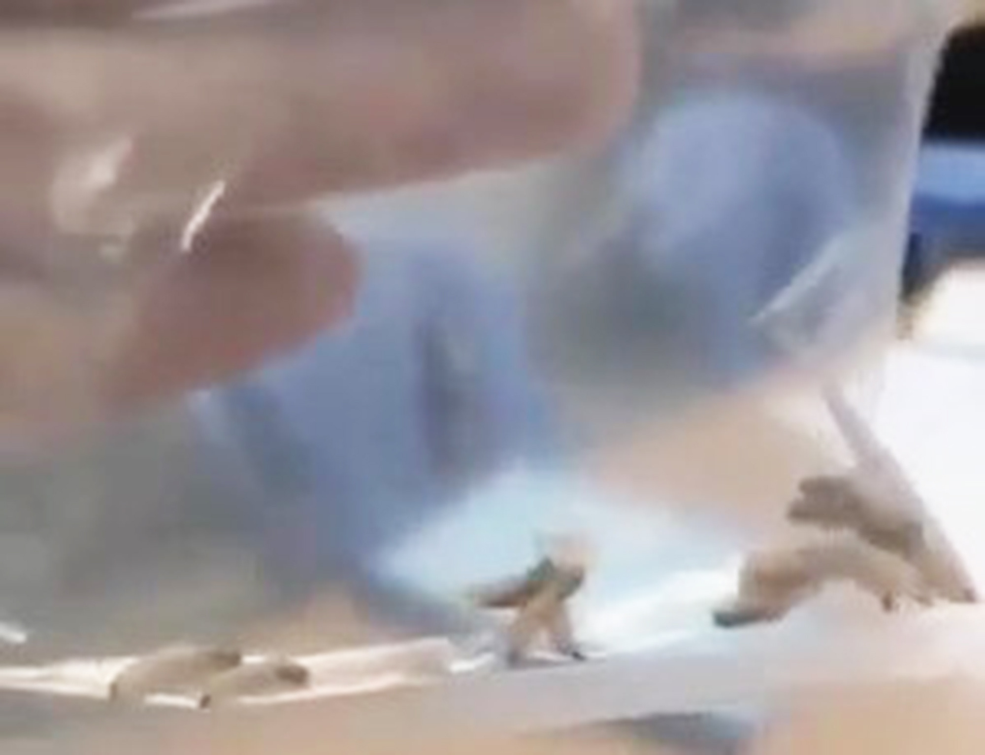 Bắt sống 40 con giòi cư ngụ trong tai người đàn ông ở Quảng Nam - Ảnh 1. Bắt sống 40 con giòi cư ngụ trong tai người đàn ông ở Quảng Nam - Ảnh 1.