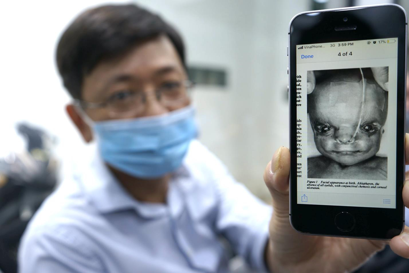 Giải mã nỗi đau dị tật bẩm sinh - Ảnh 1.
