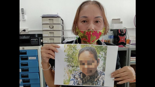 Nhiều phụ nữ và cả nam giới than phiền rụng tóc sau tiêm vắc xin COVID-19 - Ảnh 2. Nhiều phụ nữ và cả nam giới than phiền rụng tóc sau tiêm vắc xin COVID-19 - Ảnh 2.