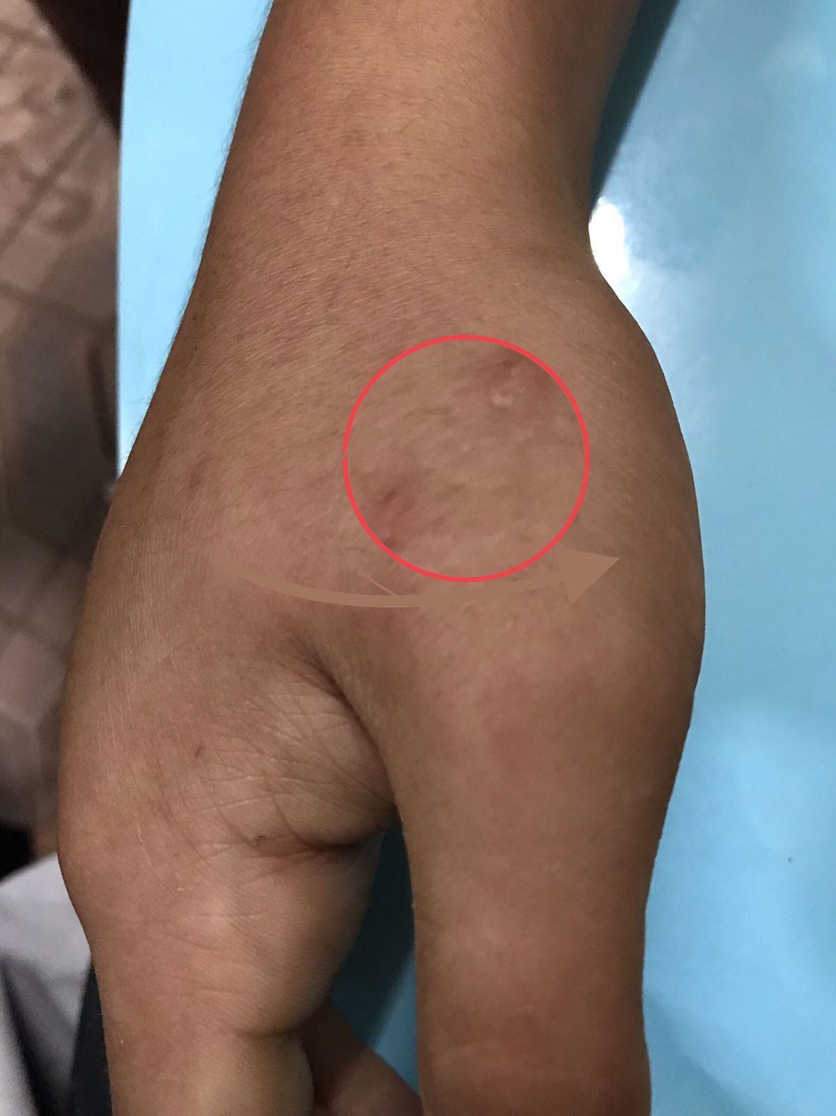 Bị rết cắn, chớ nên dùng nước dãi gà cấp cứu - Ảnh 1. Bị rết cắn, chớ nên dùng nước dãi gà cấp cứu - Ảnh 1.