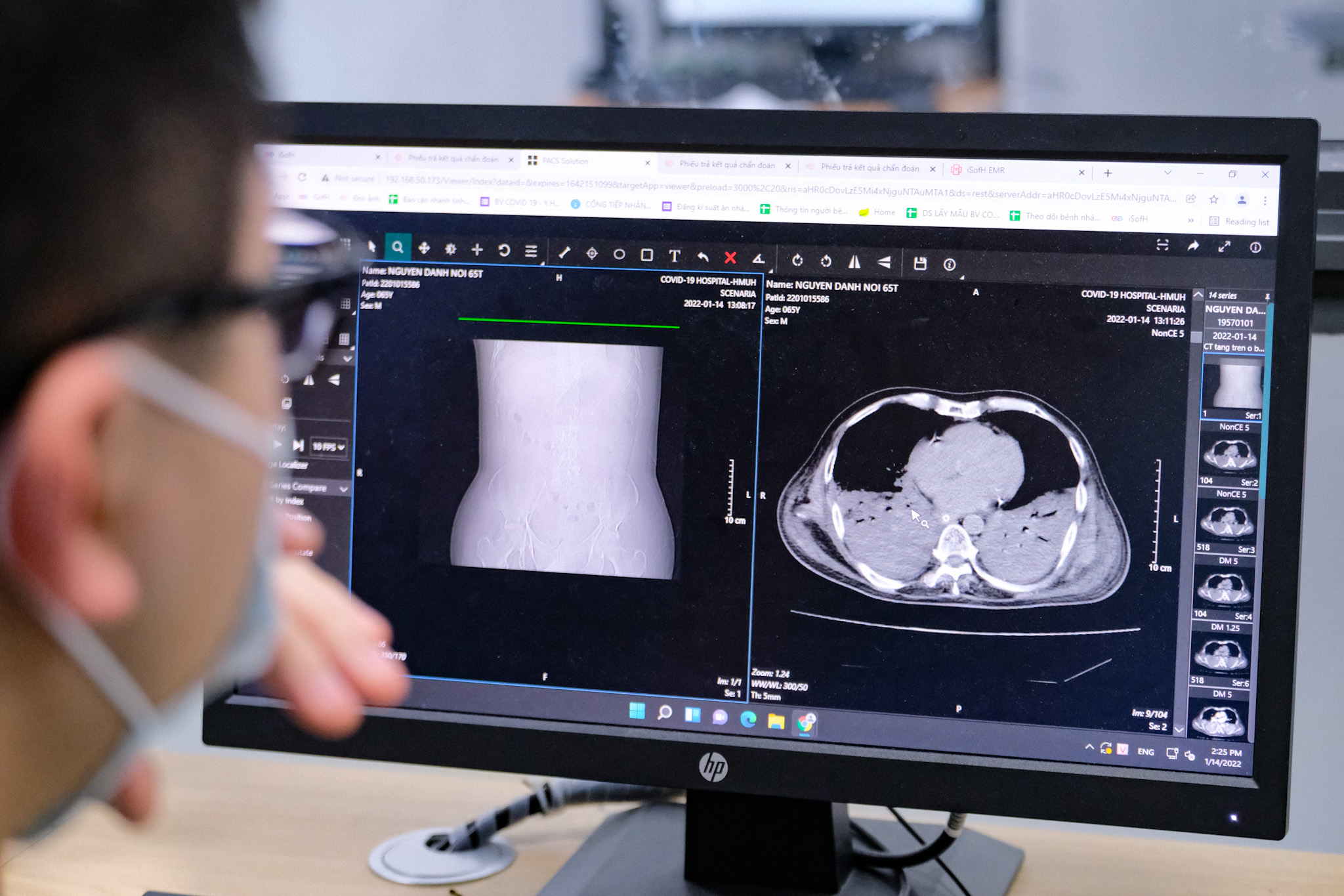 Tin sáng 30-3: Đến nay Hà Nội gần 1,5 triệu ca COVID-19, cứ 5 người có 1 người nhiễm - Ảnh 1.