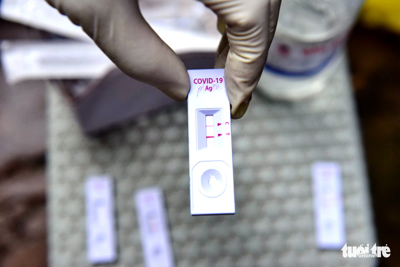 Test nhanh COVID-19: Vạch đậm - nhạt có thể hiện bệnh nặng - nhẹ? - Ảnh 1. Test nhanh COVID-19: Vạch đậm - nhạt có thể hiện bệnh nặng - nhẹ? - Ảnh 1.