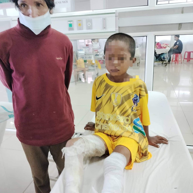 Khởi tố thanh niên đốt bỏng hai chân cháu bé 8 tuổi - Ảnh 1. Khởi tố thanh niên đốt bỏng hai chân cháu bé 8 tuổi - Ảnh 1.