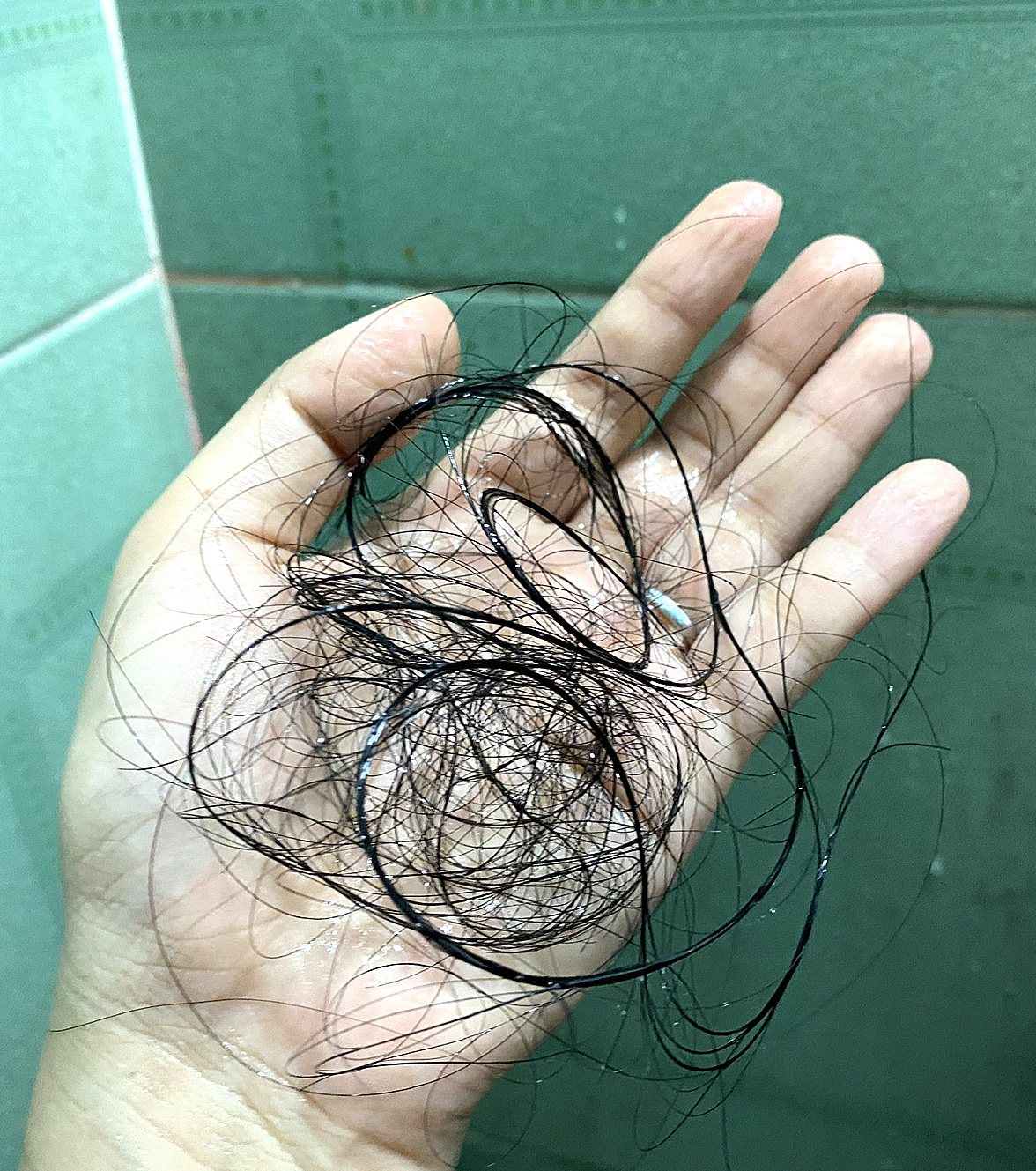 Rụng tóc mùa thu: Những bất thường cần chú ý - Ảnh 1.