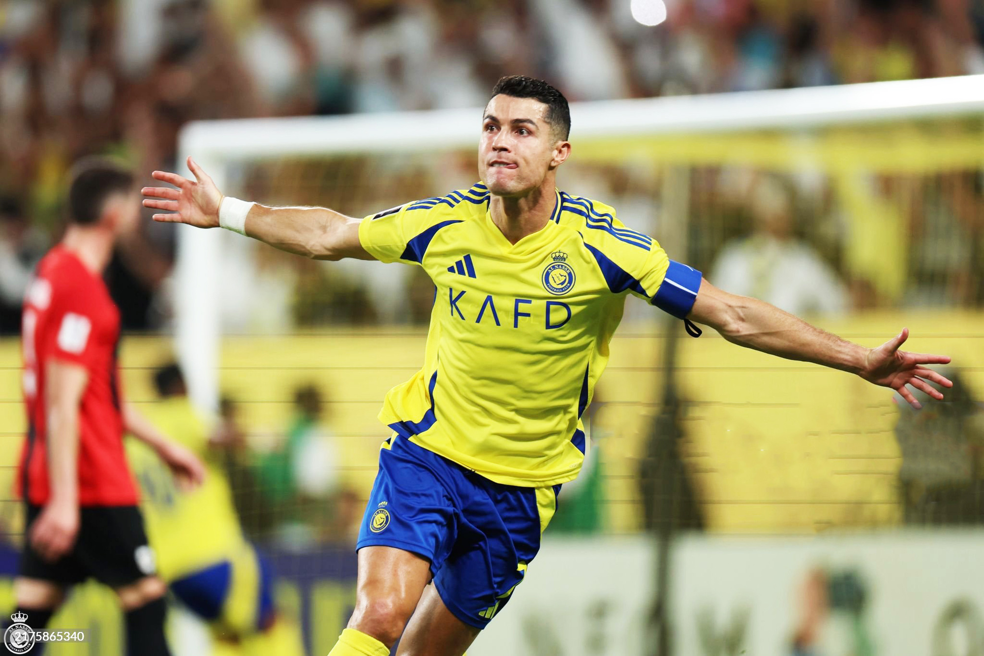 Vì sao Ronaldo sơn móng chân màu đen? - Ảnh 3.