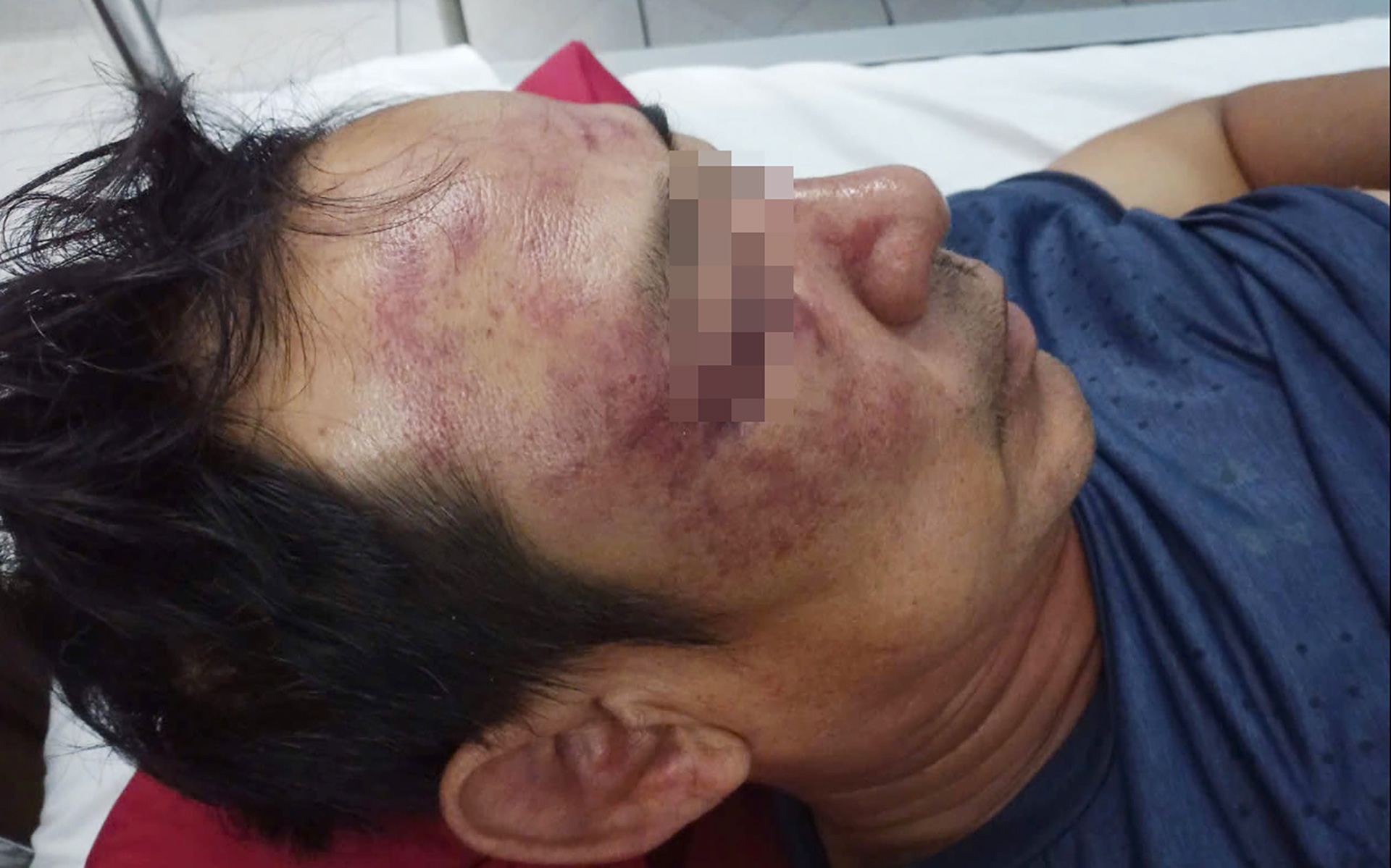 Nhóm đánh người đăng thơ lên Facebook khai cay cú vì nạn nhân châm biếm giải bóng chuyền - Ảnh 1. Nhóm đánh người đăng thơ lên Facebook khai cay cú vì nạn nhân châm biếm giải bóng chuyền - Ảnh 1.