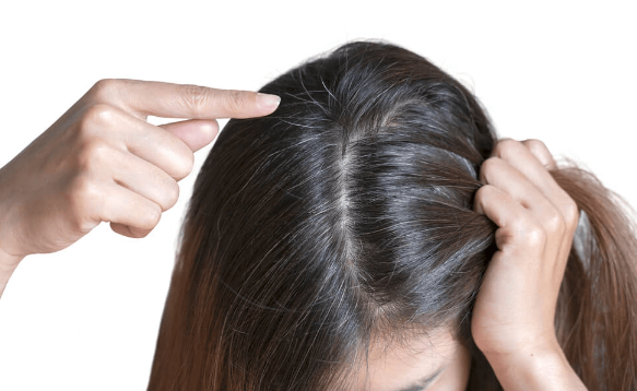 Hiện tượng tóc bạc ở trẻ em có đáng lo âu? - Ảnh 2.