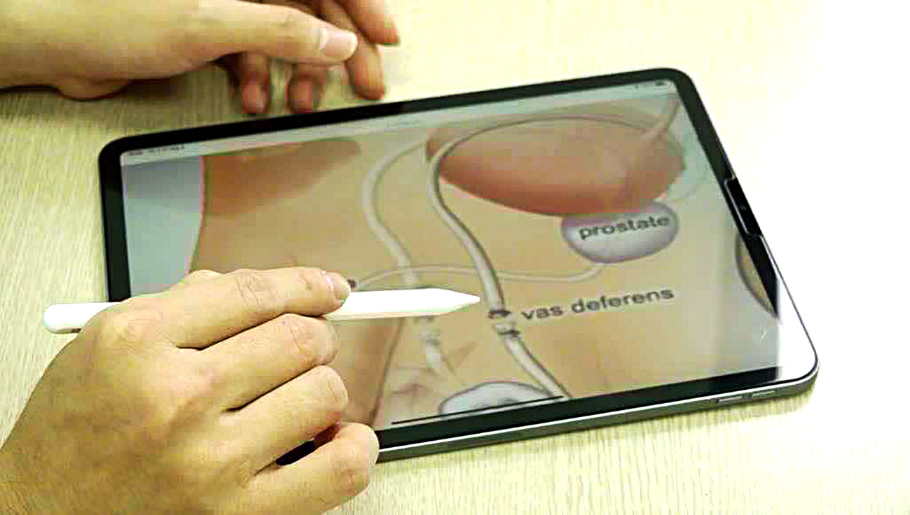 Dùng bao cao su có tránh được sùi mào gà sinh dục? - Ảnh 1.