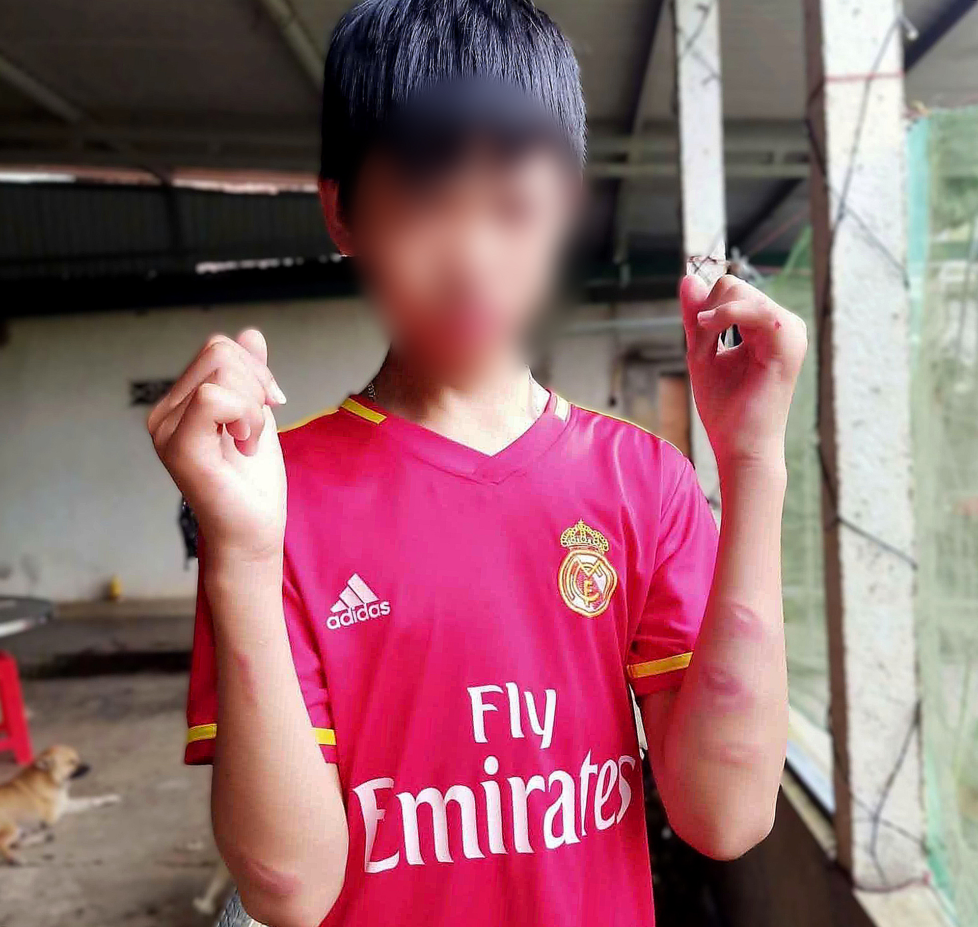 Nam sinh bị nhóm bạn đánh bầm tím trên đường đi học về, trường đang xác minh - Ảnh 1.