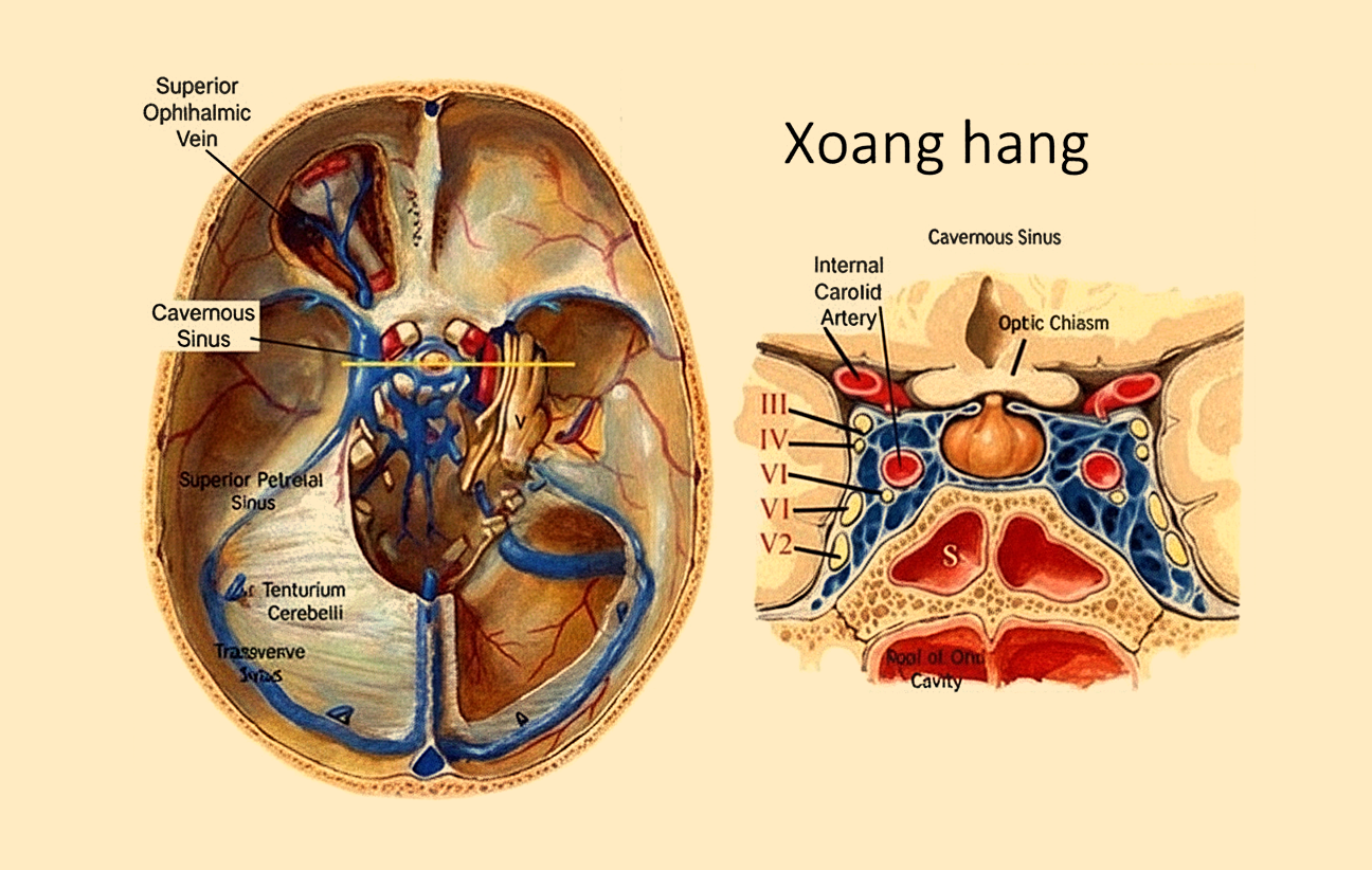 Ngạt mũi, đau đầu, thanh niên 25 tuổi nhập viện vì nhiễm trùng sọ - Ảnh 1.