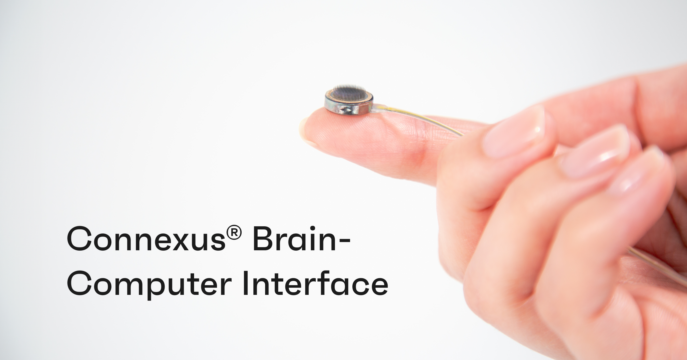 cấy chip - Ảnh 1.