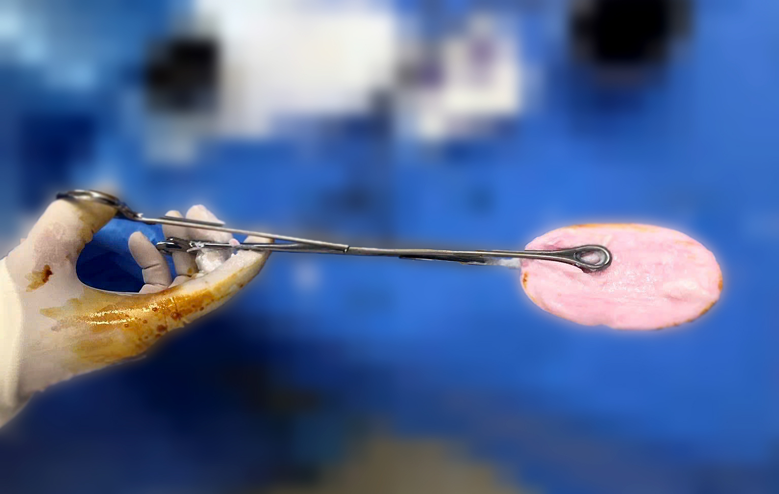 Bác sĩ cảnh báo xu hướng đáng lo gia tăng ở nhóm trẻ gái 10-16 tuổi - Ảnh 1.