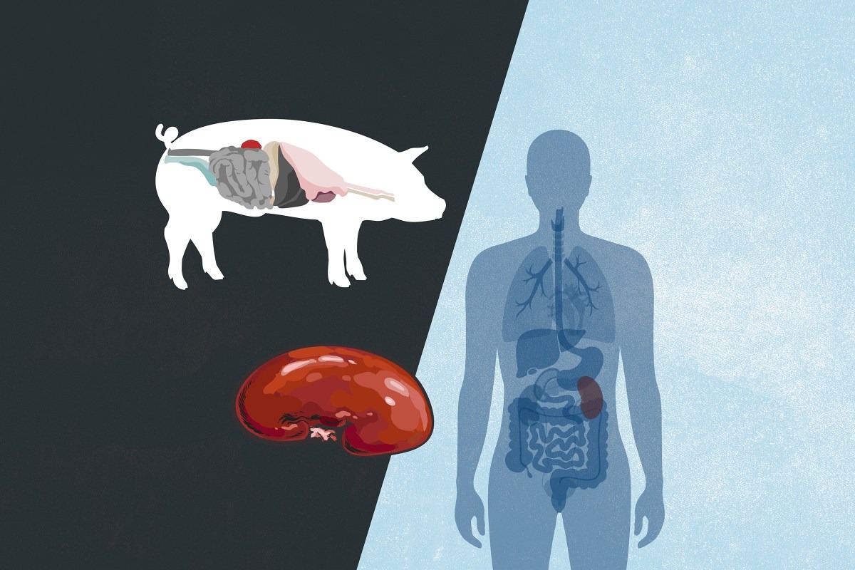 Vì sao Mỹ ghép tạng heo cho người nhưng cấm tạo tạng người trong heo? - Ảnh 1.