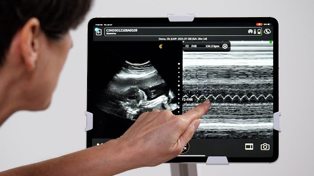 Siêu âm tim thai - Ảnh 1.