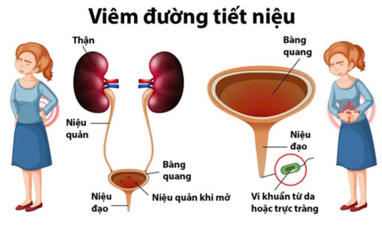 mãn kinh - Ảnh 1.