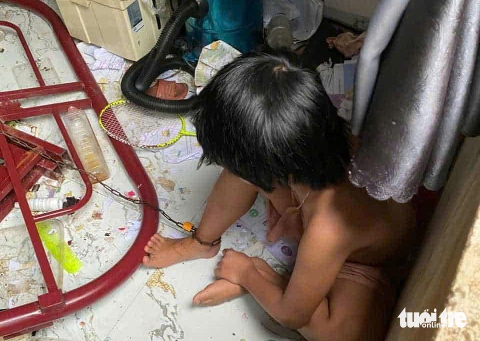 xích chân - Ảnh 1.