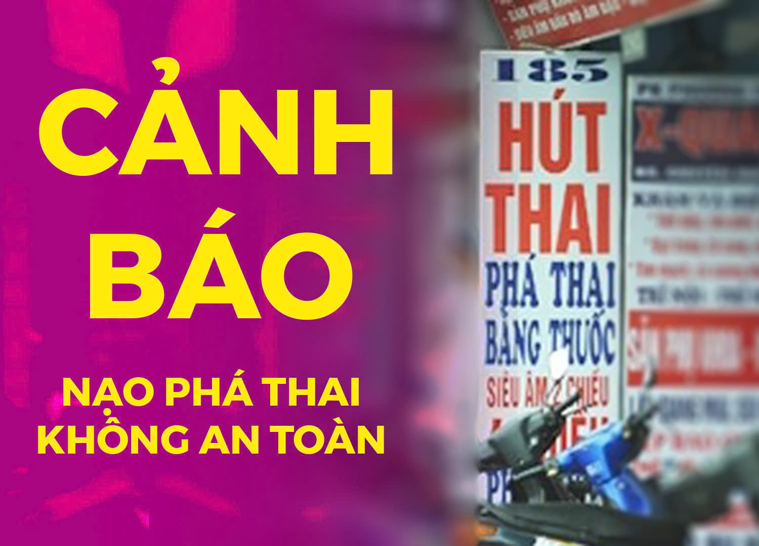 Cấp cứu một phụ nữ nguy kịch do nạo phá thai ở phòng khám tư - Ảnh 1.