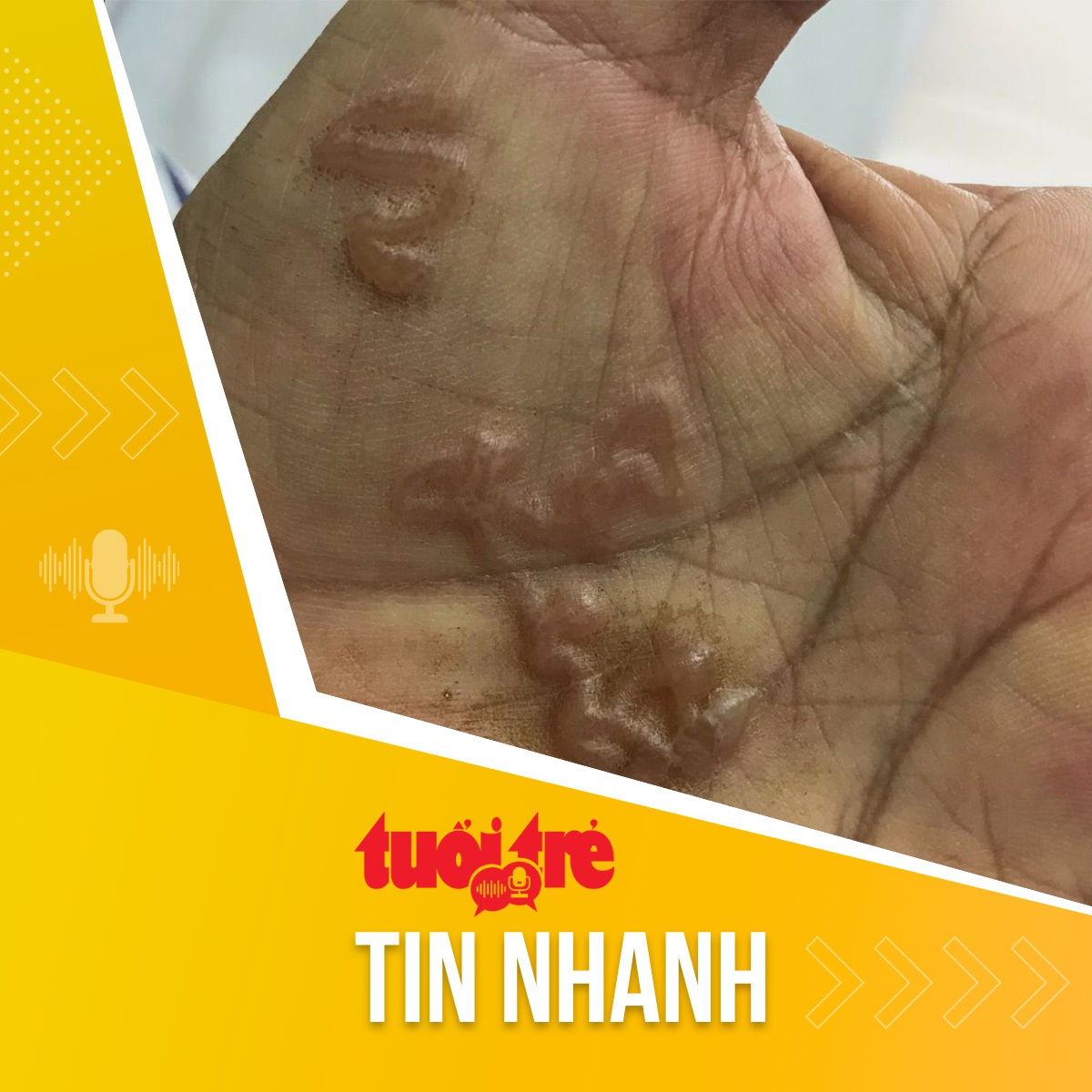 Tin tức sáng 11-3: Gia tăng người nhiễm giun sán từ chó mèo - Tuổi Trẻ ...