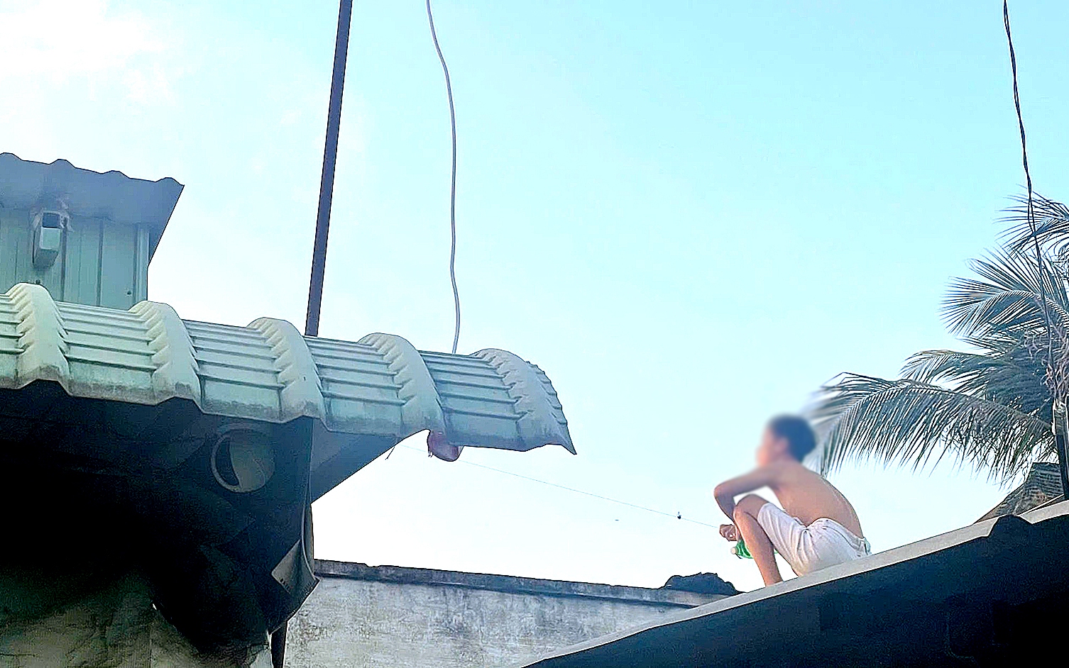 Thả diều vướng vào đường điện cao thế, bé trai 12 tuổi bị phóng điện gây bỏng nặng - Ảnh 2.